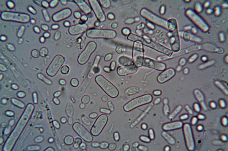 BACTERIA “COME CARNE” MANTIENE EN ALERTA A SOUTH FLORIDA TRAS CINCO CASOS CONFIRMADOS